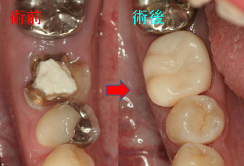 わざわざ沖縄から治療に！！ - EE DENTAL_Blog